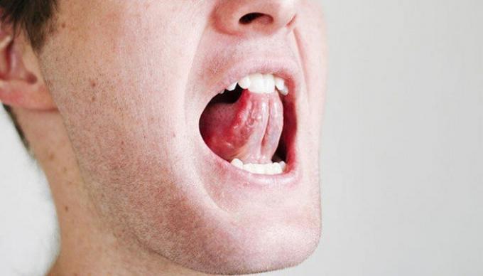 Et par enkle øvelser for halsen og tungen kan lette situationen med snorken. / Foto: i2.wp.com. 